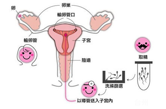 三代供精有多难？