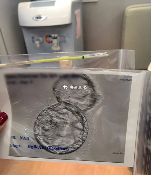 赠卵试管婴儿需要多长时间才能检测出怀孕？试纸能检测出怀孕吗？