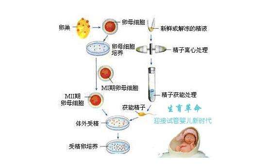高级女性请注意!请在供卵做试管婴儿胚胎移植前做好准备工作