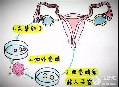 精子库可以选民族吗