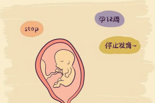 好孕接力!关于马来西亚借卵做供卵试管代生使用指南