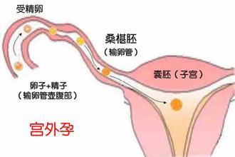 武汉可以做供卵试管婴儿的医院