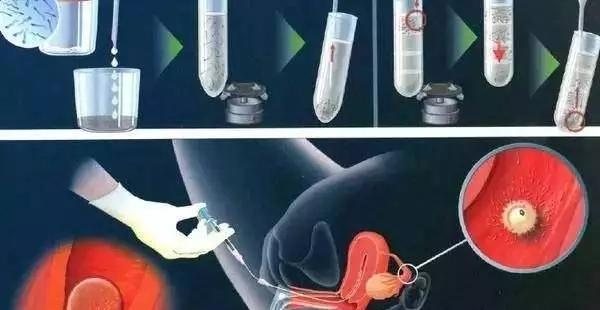 供卵试管期间男方感冒影响不