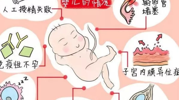 y染色体微缺失做几代供卵做试管