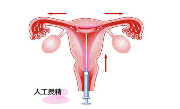 未婚做试管多少钱