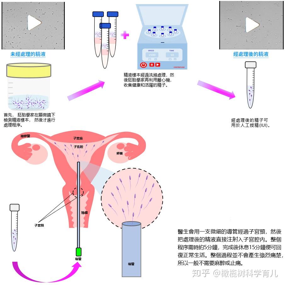 试管婴儿最大年龄是多少