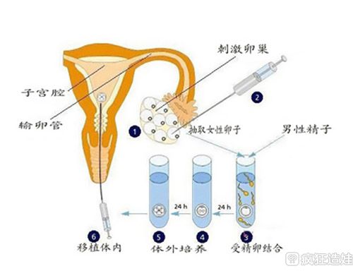 试管婴儿最大年龄是多少