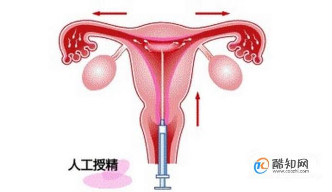 男的不育可以做试管吗