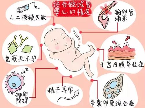 试管婴儿都是女孩子吗