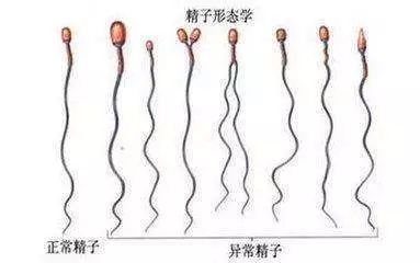 试管婴儿必须查染色体吗