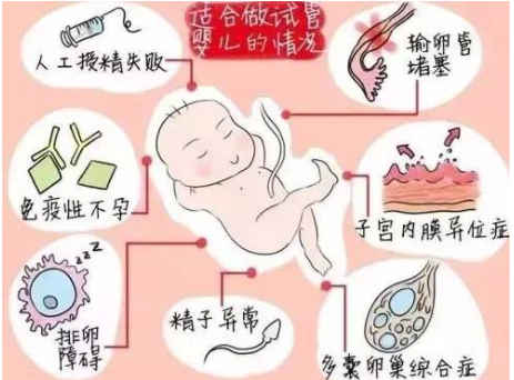 如何去武汉做第供卵代怀生男孩