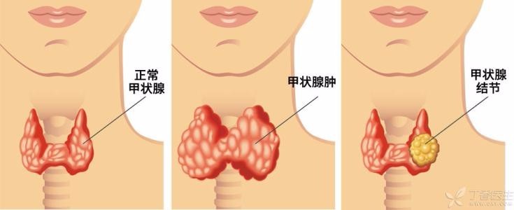 武汉代怀双胞胎不用证件+有离婚证可以同性代怀生子吗