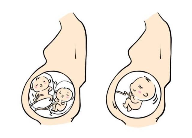 武汉代怀双胞胎不用证件+有离婚证可以同性代怀生子吗