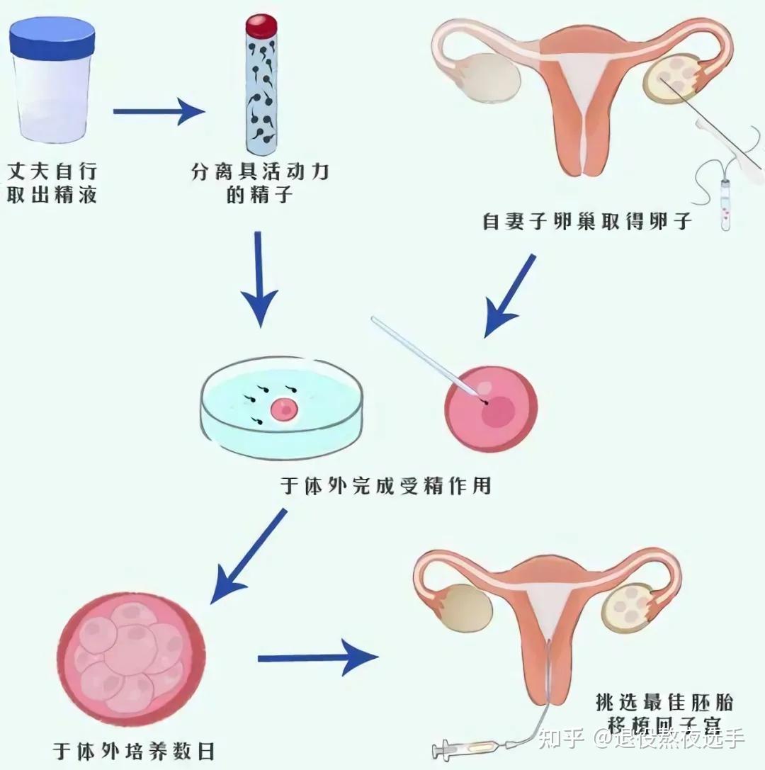 弱精症去湖北武汉鼓楼做试管找哪个医生好？
