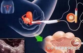 唐都医院做借卵试管医院男女双方前期检查项目各有哪些