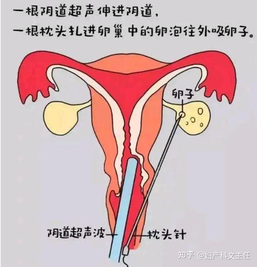 女人生不出男孩的原因,和女性有关吗