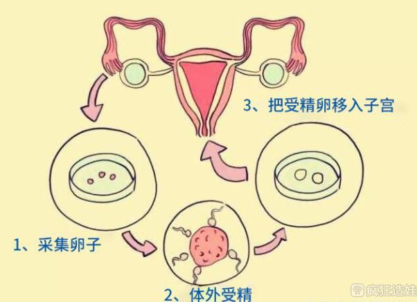 女人生不出男孩的原因,和女性有关吗