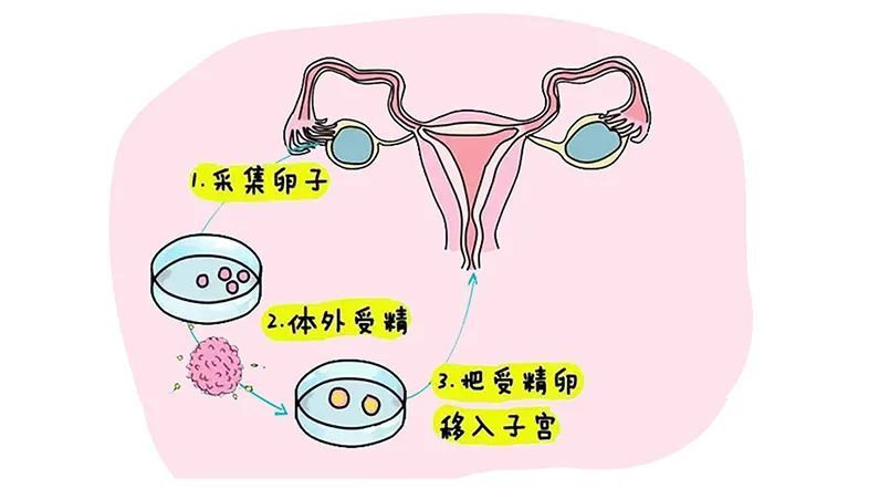 湖北武汉捐卵供卵,中介赚得盆满钵满
