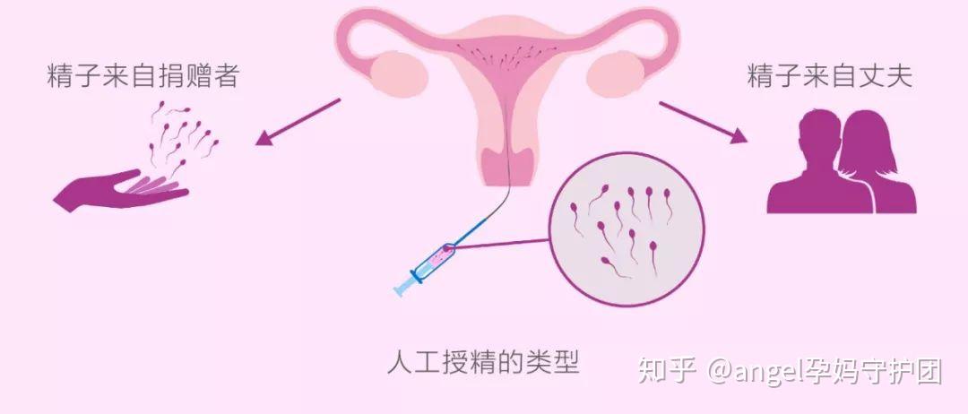 自然怀上单卵双胎是谁的功劳,男方还是女方+