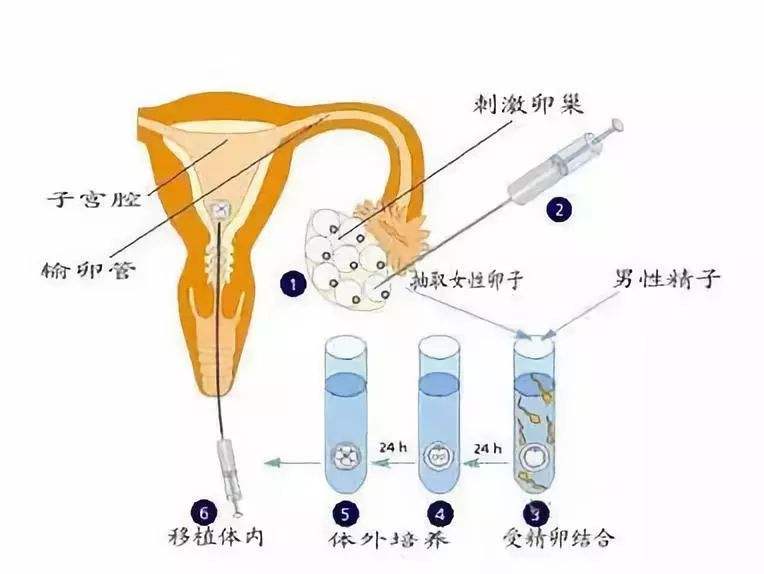 三分钟带你了解去湖北武汉代怀三代试管的手续流程
