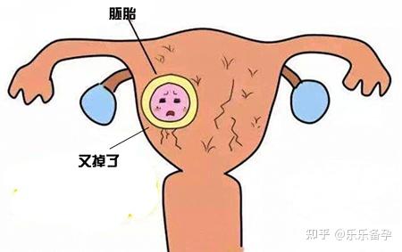 北医三院拮抗剂方案移植囊胚成功率有多大